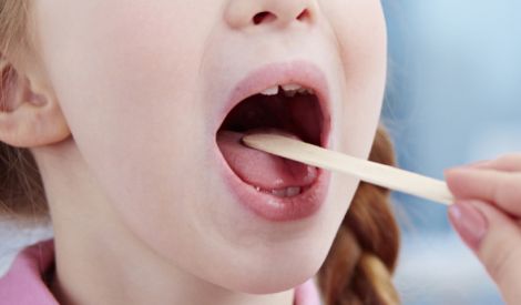 لماذا لا يُشجع العلماء على استئصال اللوزتين؟