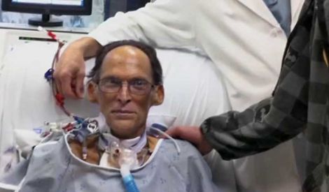 أول إنسان يعيش بدون قلب 